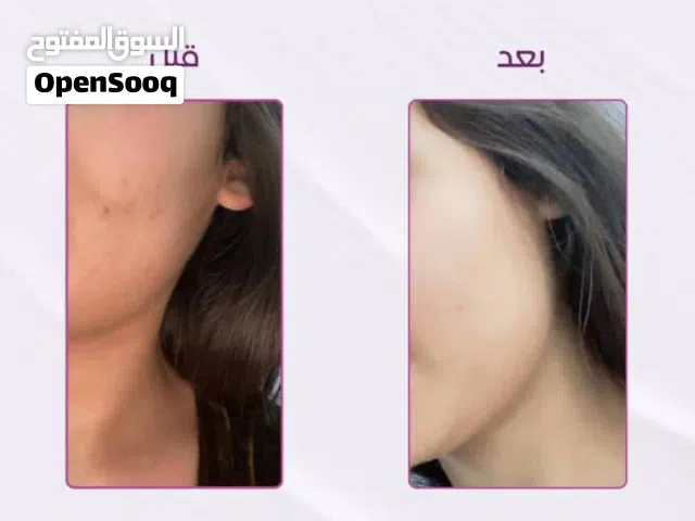 كوين سنتر لتبييض وتفتيح البشرة