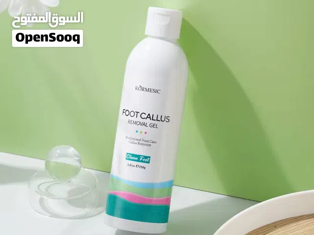 كالوس القدم
