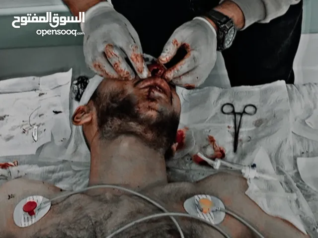 ممرض لعندك يجيك فالحوش