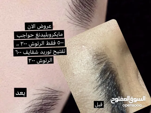 مايكروبليدنغ مايكروشيدنغ تفتيح توريد