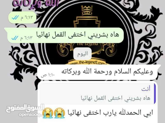 زيت لازاله القمل والصيبان