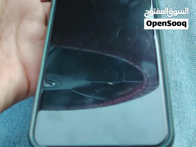 Xs كويس بإذن الله