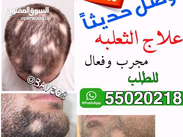 علاج الثعلبه التايلندي