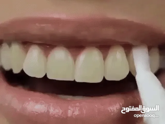 قلم تبييض الأسنان الفوري. لبنان