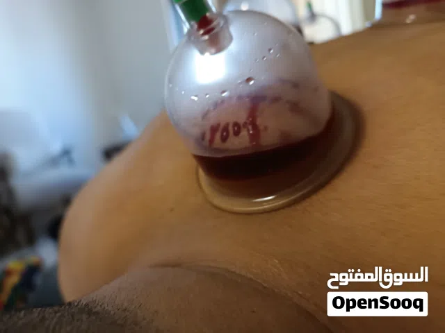 معالج رياضي مختص في تأهيل جميع انواع الإصابات و التدليك العلاجي و الاسترخائي والحجامة بكافة أنواعها