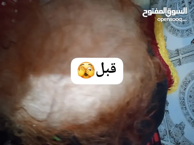 مجموعة مضادة لتساقط الشعر وتحفيز نمو الشعر مع المستخلصات الرئيسية للزيوت الأساسية من 7 أعشاب ثمينة