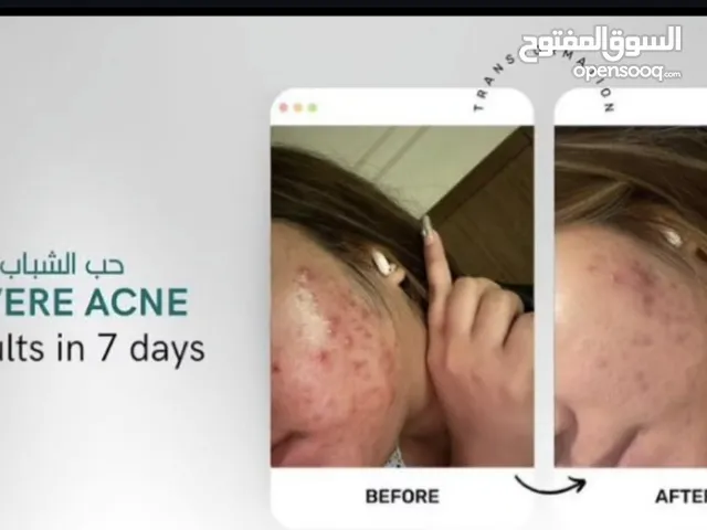 منتجات الصحة والمناعة والرياضة وكل شيء تريده