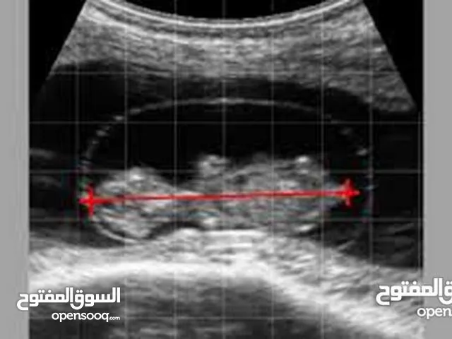 فحص الحمل في الحيوانات بالسونار (الأشعة التلفزيونية)