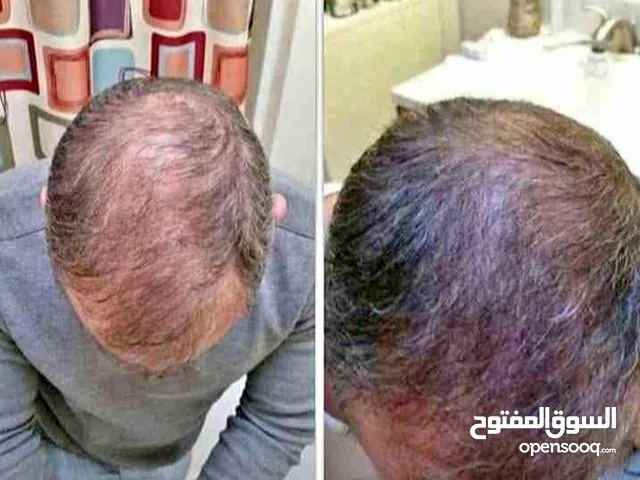 **كابينوفا( capinova) زيت للعناية بالشعر . تركيبة من الزيوت الطبيعية بدون أي إضافات كيميائية.