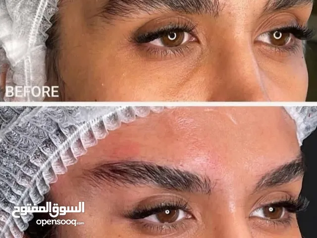 عملیه تجمیل الانف فی ایران الاهواز