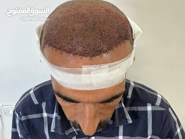 زراعة شعر ،لحيه و حاجب في ايران_الاهواز _تجميل اسنان