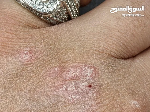 زفير سيلاني طبيعي يبرق