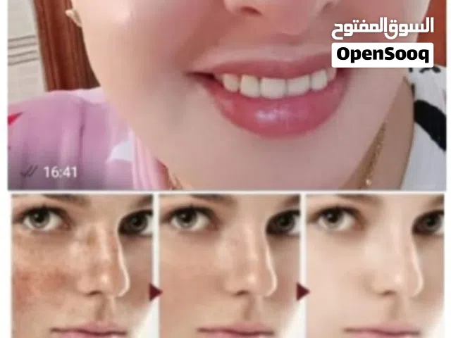 كريم لإزالة الكلف والنمش وتوحيد لون البشرة