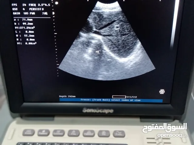 سونار سونسكيب A6 بحاله ممتازه