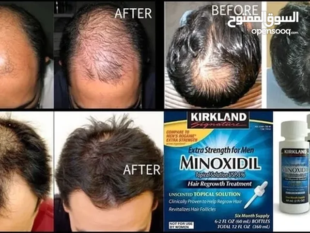 minoxidil منتج منع الصلع ونمو الشعر واللحيه