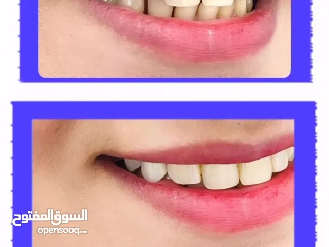 مجاني فترة محدوده