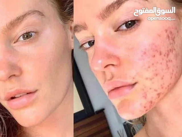 غسول انوا الرغوي للتنظيف العميق للمسام  رغوة تنظيف عميقة للمسام بمستخلص هارت ليف توفر تنظيفاً