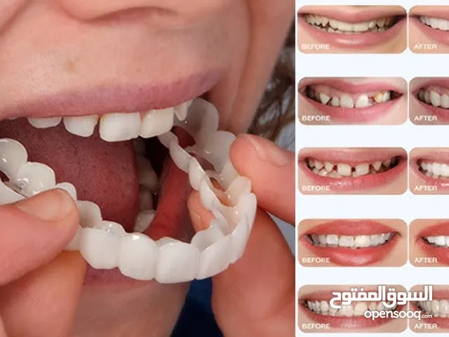 ( Snapon smile)   ابتسامه فينير متحركه....   وداعا للاسنان المنفصلة والغير لائقه والتسوس  لتسطيع الح