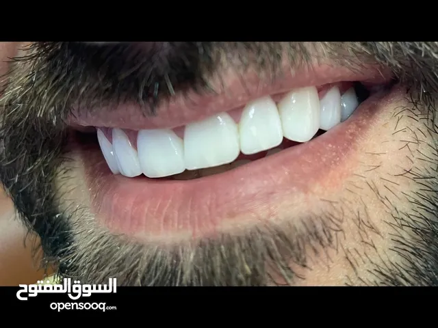 تجميل الاسنان
