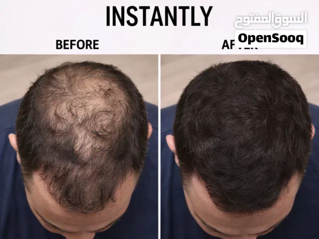 المادة السحرية لتغطية فراغات الشعر والصلع فوراً (ضد الماء) - للرجال والنساء