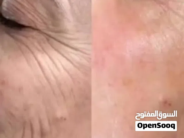خيوط شد فورية في المنزل