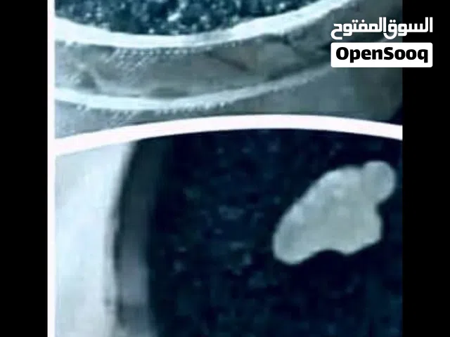 ألماسة حقيقية تشبه جسم الإنسان