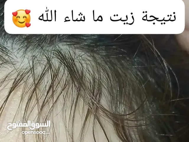 زيت الشعر السحري