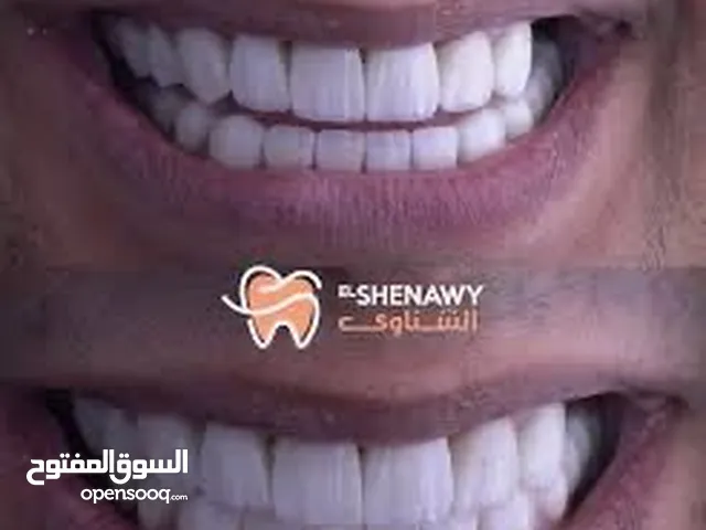 السلام عليكم ابتسامة فينير ممتازه نفسها لا تسبب رائحة في الفم عليها عرض للعيد للتواصل على نفس الرقم