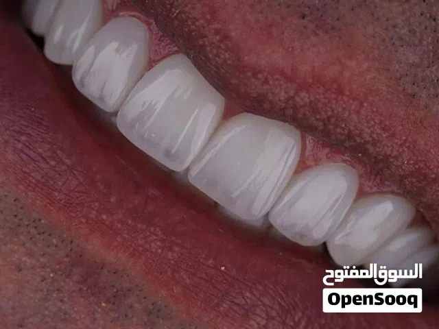 ابتسامه هوليود زركونيا 80دولار