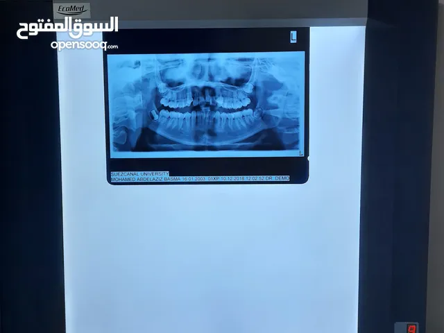 جهاز رؤية أشعة x-Ray reader