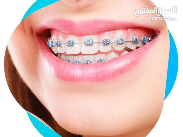 اسعار تقويم الاسنان في خميس مشيط