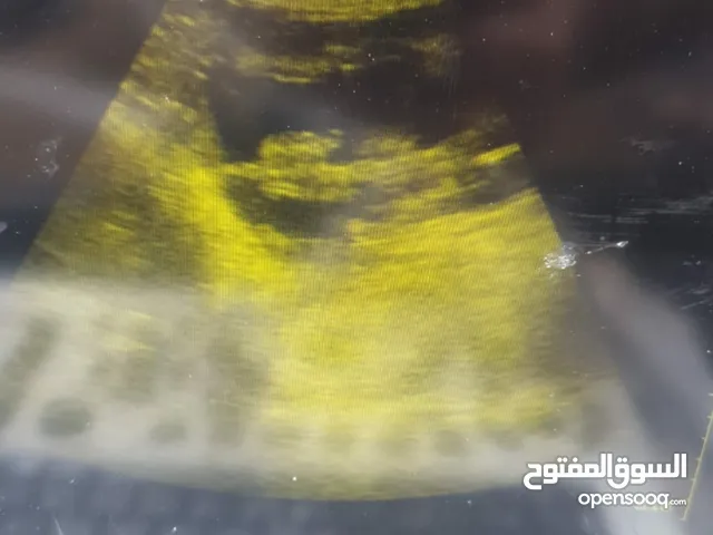 غسيل مع فحص بالسونار للبوش