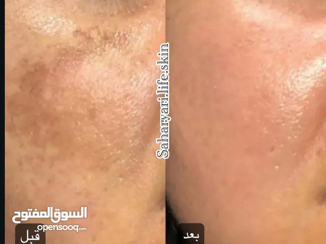 Facial home services equipment and skin care treatment