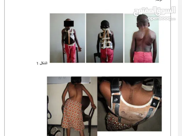 اسرار العمود الفقري