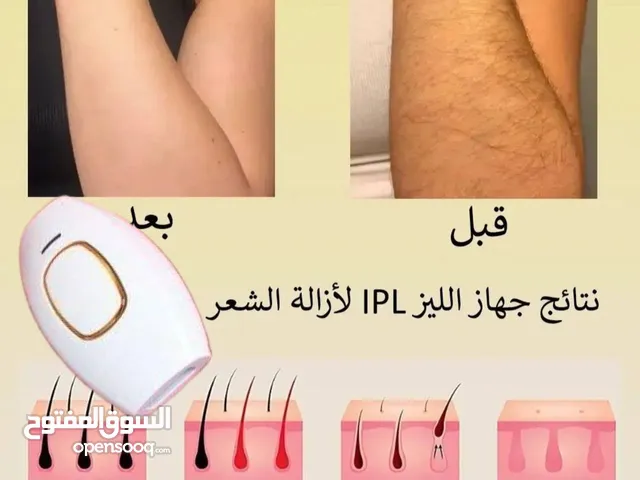 جهاز ليزر لازاله الشعر