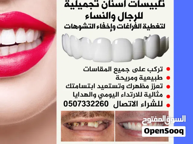 اغطية اسنان تجميلية