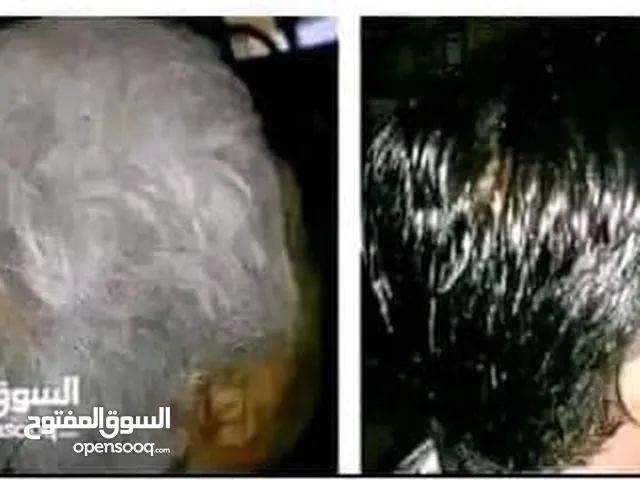ودّع الشيب واسترجع شباب شعرك! مع شامبو الشيب بالأرغان، علاج طبيعي وفعّال لمشكلة الشيب المبكر.