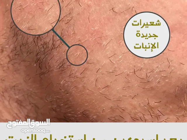 تبي لحية مميزة؟ خلي زيت تحفيز بصيلات اللحية يكون جزء من روتينك، اطلب عرض الحبتين الحين قبل نفاذ الكم