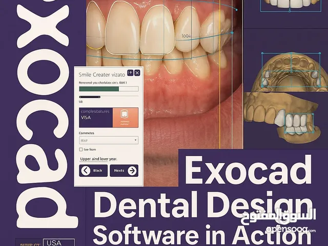 Exocad limited time offer