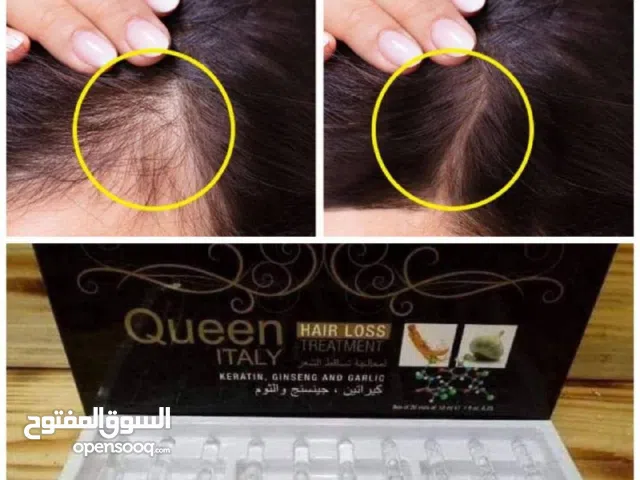 واخيراا توفرت بعد طول انتظارر أفضل علاج لتساقط الشعر  بكج امبولات كوين لتساقط شعر  #الأصلية