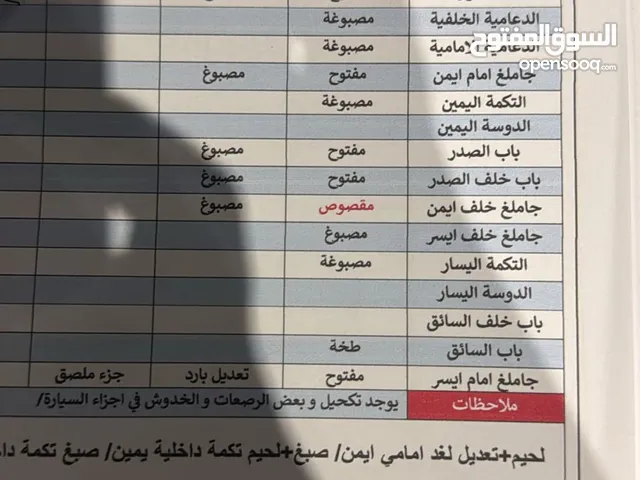 اتصل تدلل باقي تفاصيل اشرحن